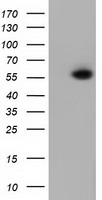 HEK293T cells were transfected with the pCMV6-ENTRY control (Left lane) or pCMV6-ENTRY PEPD (Right lane) cDNA for 48 hrs and lysed
