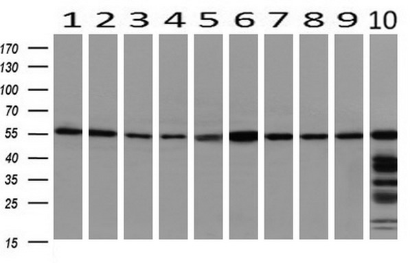 Western blot analysis of extracts (10ug) from 10 Human tissue by using anti-PEPD monoclonal antibody at 1:200 (1: Testis; 2: Omentum; 3: Uterus; 4: Breast; 5: Brain; 6: Liver; 7: Ovary; 8: Thyroid gland; 9: colon;10: spleen)