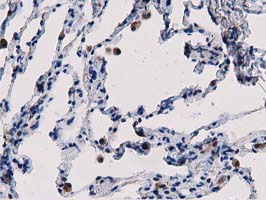 m03417 anti pepd mouse monoclonal antibody clone id oti5d5 ihc testing 10