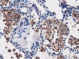 m03417 anti pepd mouse monoclonal antibody clone id oti5d5 ihc testing 3