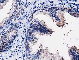 m03417 anti pepd mouse monoclonal antibody clone id oti5d5 ihc testing 5