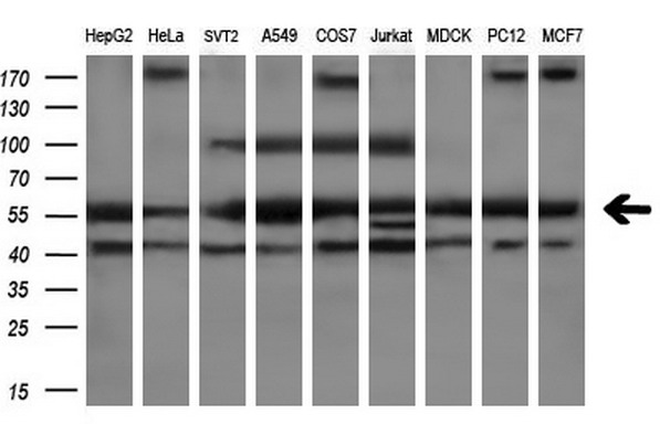 m03417 anti pepd mouse monoclonal antibody clone id oti5d5 wb testing 2
