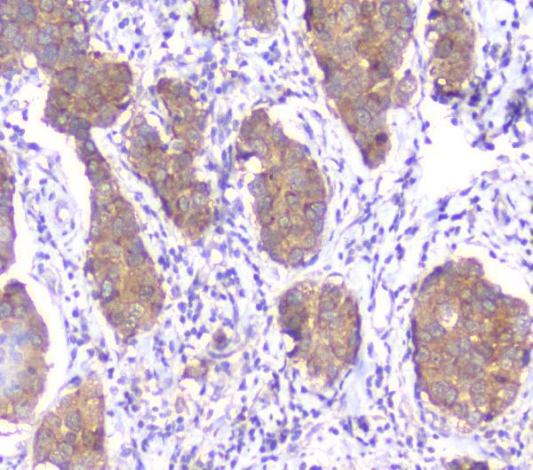 m03420 1 smn1_2 primary antibodies ihc testing 2