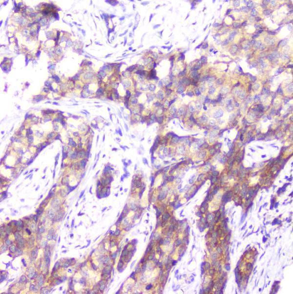m03420 1 smn1_2 primary antibodies ihc testing 3