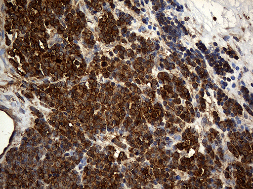 m03423 anti arp3 actr3 mouse monoclonal antibody clone id oti5g4 ihc testing 3