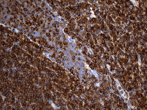 m03423 anti arp3 actr3 mouse monoclonal antibody clone id oti5g4 ihc testing 4
