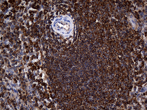 m03423 anti arp3 actr3 mouse monoclonal antibody clone id oti5g4 ihc testing 5