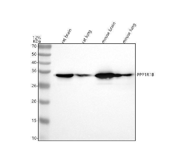  Western blot analysis of PPP1R1B using anti-PPP1R1B antibody (M03424)