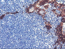 m03427 anti serpinb2 mouse monoclonal antibody clone id oti1f6 ihc testing 3