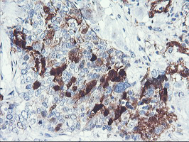 m03427 anti serpinb2 mouse monoclonal antibody clone id oti1f6 ihc testing 4