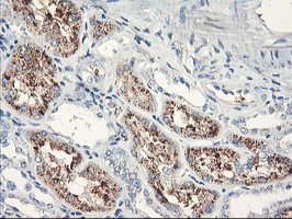 m03427 anti serpinb2 mouse monoclonal antibody clone id oti1f6 ihc testing 5