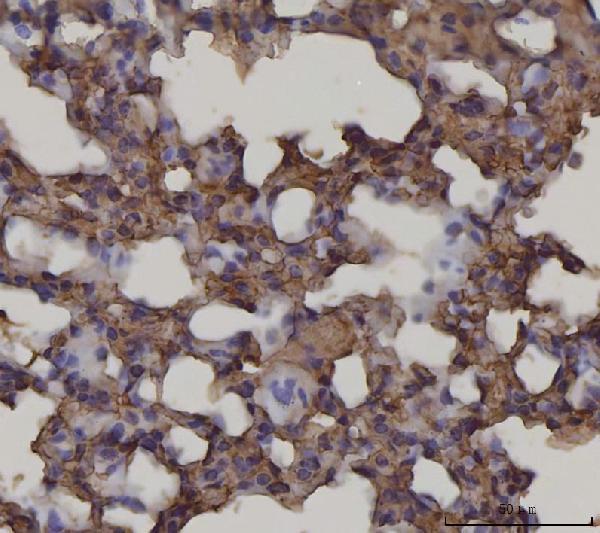 m03438 2 ager primary antibodies ihc testing 2