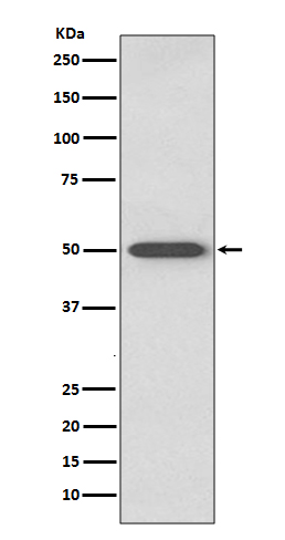 Western blot analysis of RAGE expression in mouse lung lysate