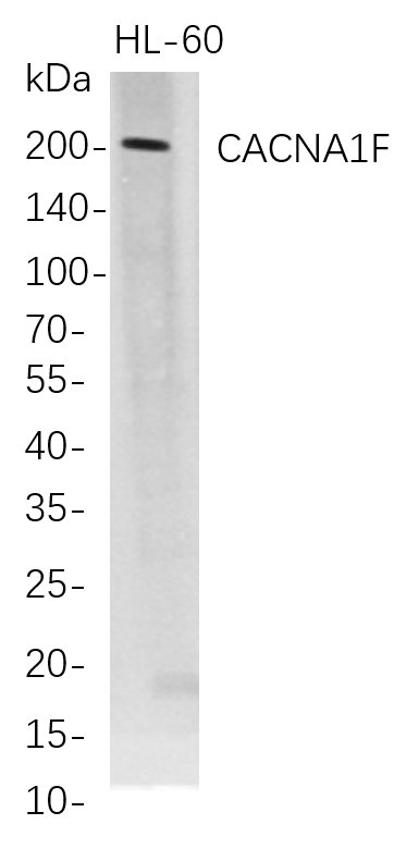 Western Blot analysis of HL-60 whole cell lysates were separated by 4-20% SDS-PAGE, and the membrane was blotted with anti-CACNA1F rabbit mAb