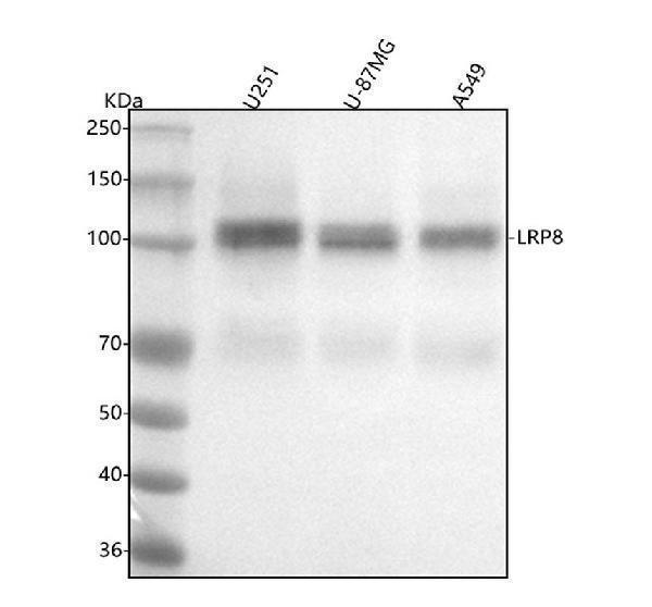  Western blot analysis of ApoER2 using anti-ApoER2 antibody (M03444)