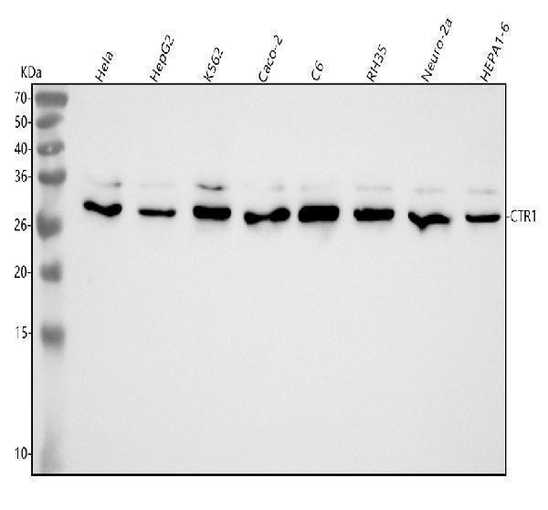  Western blot analysis of CTR1/SLC31A1 using anti-CTR1/SLC31A1 antibody (M03447)