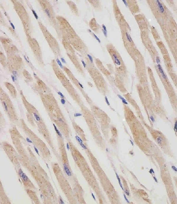 m03448 1 anti ranbp9 antibody ihc p testing 2