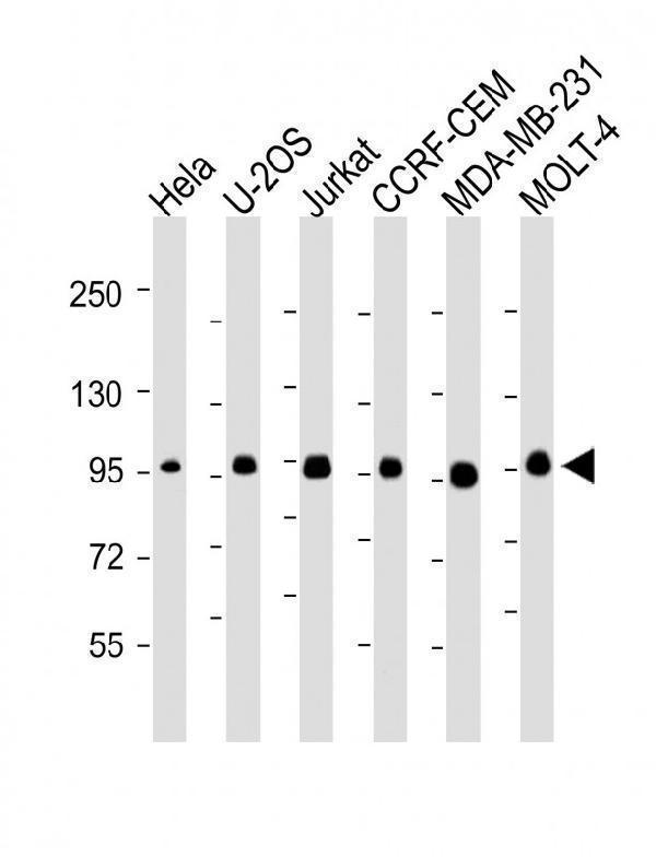 m03448 1 anti ranbp9 antibody wb testing 1