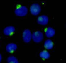 Immunocytochemistry stain of Hela using RANBP9 antibody (1:300)
