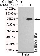 Immunoprecipitation analysis of Hela cell lysates using RANBP9 antibody