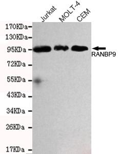 Western blot detection of RANBP9 in Jurkat, MOLT-4&CEM cell lysates and using RANBP9 antibody (1:1000 diluted) 