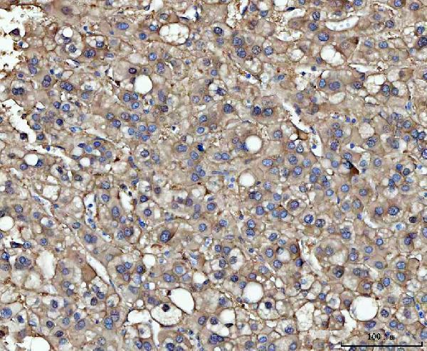 m03449 me1 primary antibodies ihc testing 2