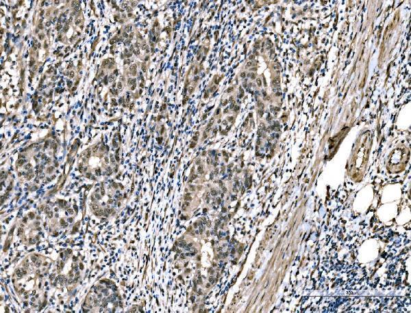  IHC analysis of DYNLL1/PIN using anti-DYNLL1/PIN antibody (M03454-1)