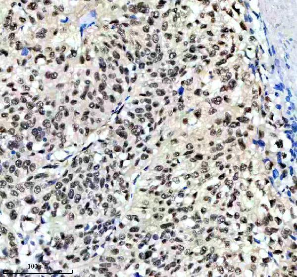 m03454 dyn1l1 primary antibodies ihc testing 10
