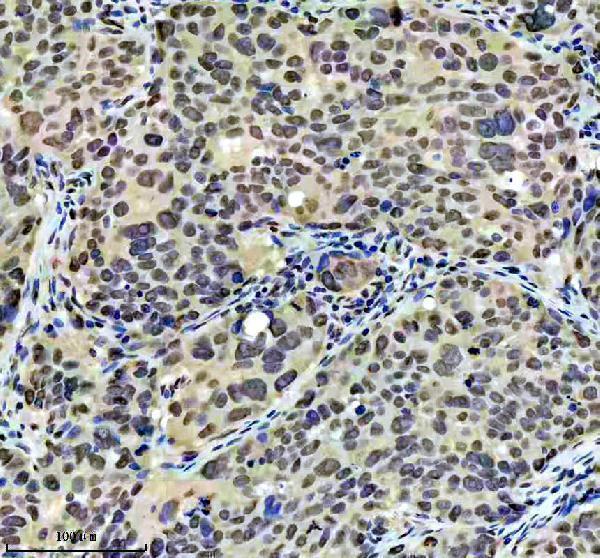 m03454 dyn1l1 primary antibodies ihc testing 11