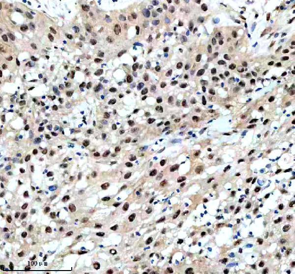 m03454 dyn1l1 primary antibodies ihc testing 2