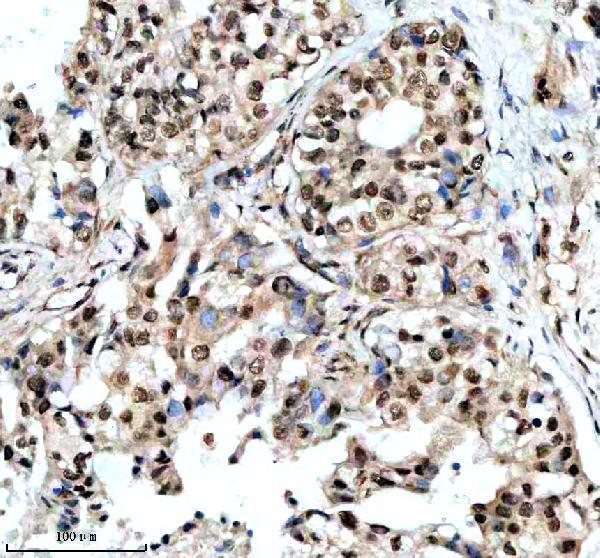 m03454 dyn1l1 primary antibodies ihc testing 3