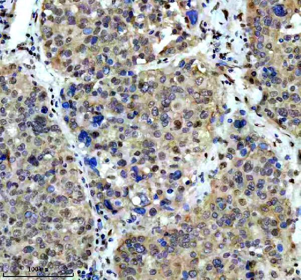 m03454 dyn1l1 primary antibodies ihc testing 4