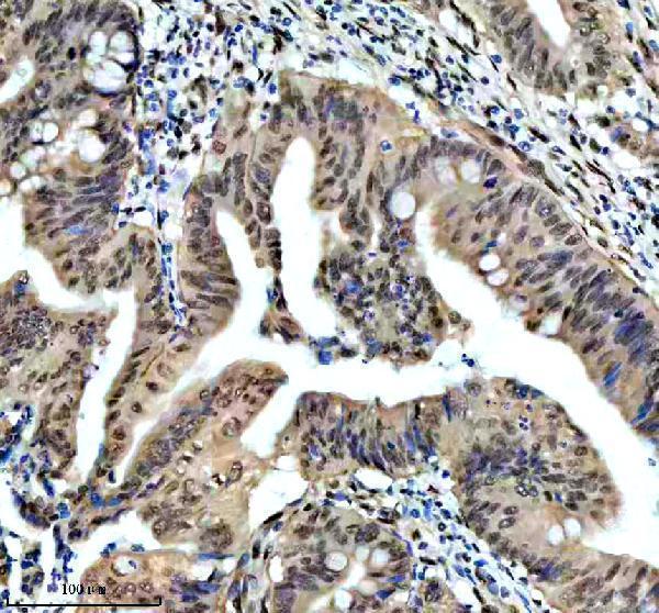 m03454 dyn1l1 primary antibodies ihc testing 5