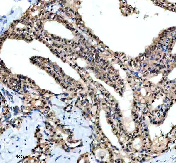 m03454 dyn1l1 primary antibodies ihc testing 6