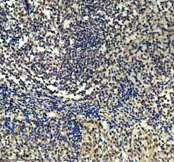 m03454 dyn1l1 primary antibodies ihc testing 8