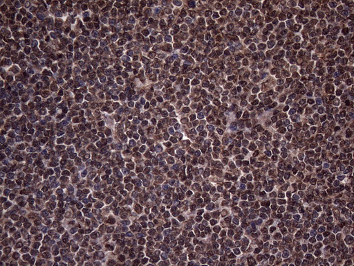 m03457 3 anti rnf20 mouse monoclonal antibody clone id oti2b9 ihc testing 2
