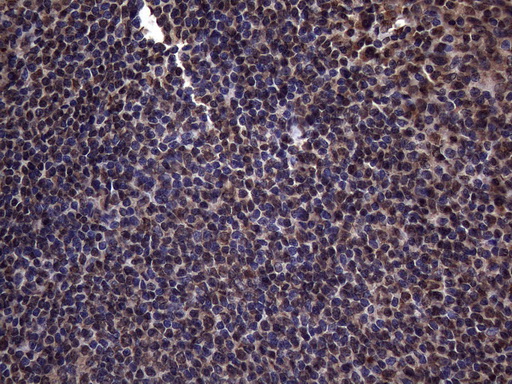 m03457 3 anti rnf20 mouse monoclonal antibody clone id oti2b9 ihc testing 3