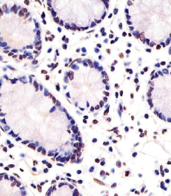m03460 anti fev antibody n term ihc p testing 2
