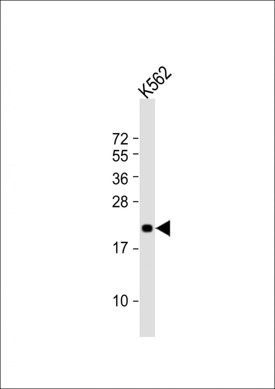 m03460 anti fev antibody n term wb testing 1