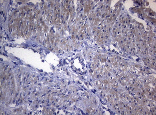 Immunohistochemical staining of paraffin-embedded Human endometrium tissue within the normal limits using anti-RAB3A mouse monoclonal antibody