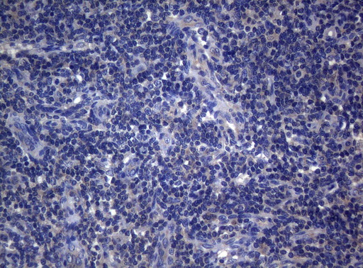 Immunohistochemical staining of paraffin-embedded Human lymph node tissue within the normal limits using anti-RAB3A mouse monoclonal antibody