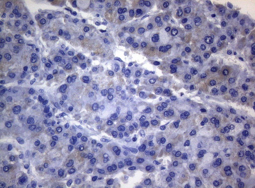 m03463 1 anti rab3a mouse monoclonal antibody clone id oti1g3 ihc testing 6