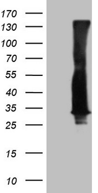 HEK293T cells were transfected with the pCMV6-ENTRY control (Left lane) or pCMV6-ENTRY RAB3A (Right lane) cDNA for 48 hrs and lysed