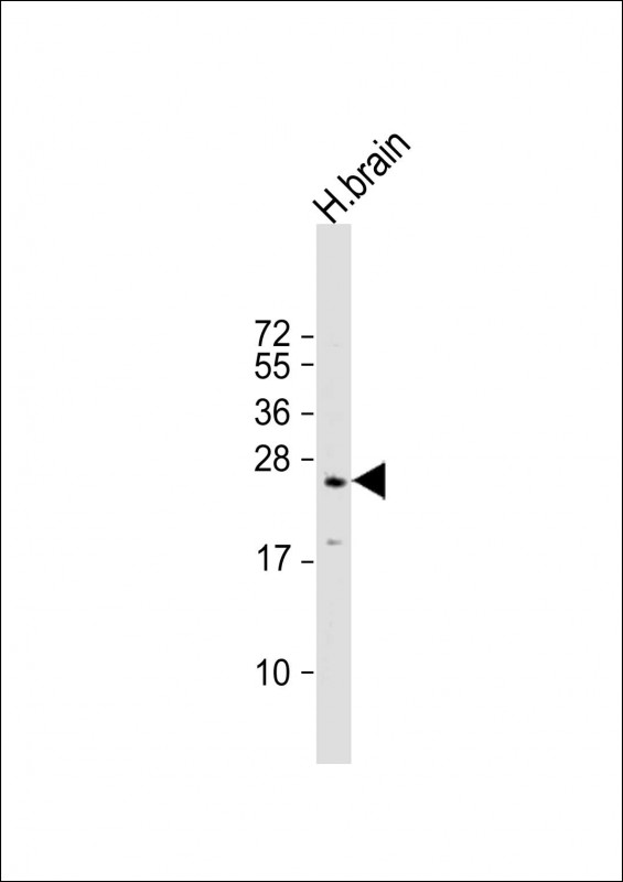Anti-RAB3A Antibody at 1:500 dilution + human brain lysateLysates/proteins at 20 μg per lane