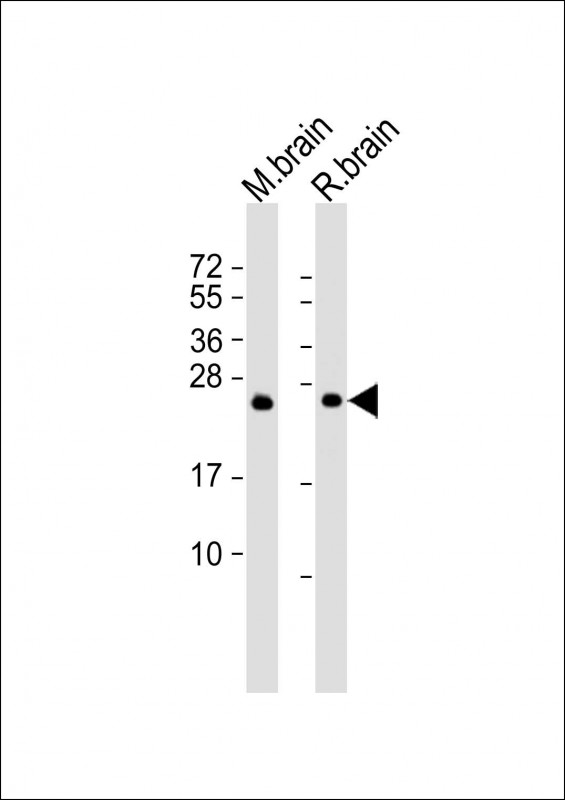 All lanes : Anti-RAB3A Antibody at 1:2000 dilutionLane 1: mouse brain lysateLane 2: rat brain lysateLysates/proteins at 20 g per lane