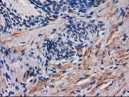 Immunohistochemical staining of paraffin-embedded Human prostate tissue within the normal limits using anti-PDE2A mouse monoclonal antibody