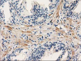 m03472 anti pde2a mouse monoclonal antibody clone id oti1g9 ihc testing 4