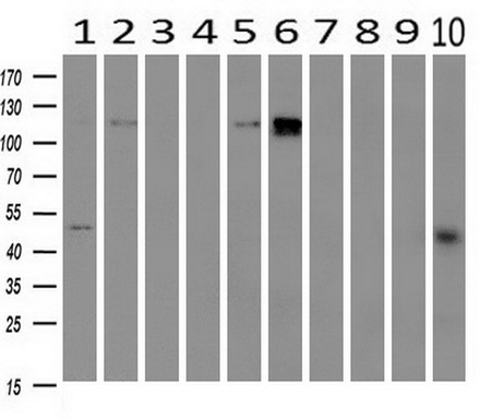 Western blot analysis of extracts (10ug) from 10 Human tissue by using anti-PDE2A monoclonal antibody at 1:200 (1: Testis; 2: Omentum; 3: Uterus; 4: Breast; 5: Brain; 6: Liver; 7: Ovary; 8: Thyroid gland; 9: colon;10: spleen)