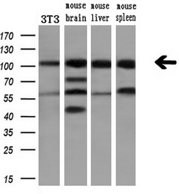 Western blot analysis of extracts (10ug) from a mouse cell line and 3 different mouse tissues by using anti-PDE2A monoclonal antibody (1:200)