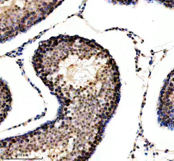 m03475 csnk2b primary antibodies ihc testing 4